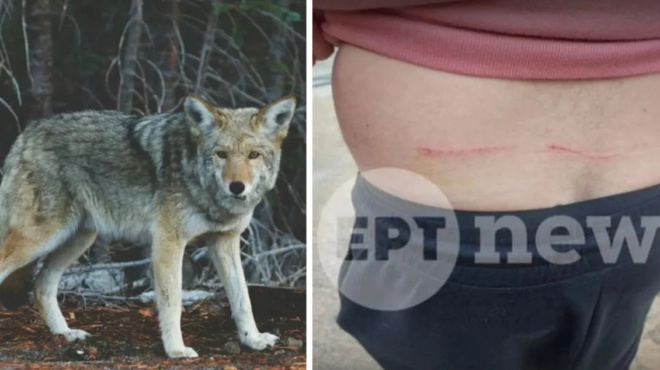 thriler-sto-tatoi-aimatiri-epithesi-lykoy-se-peripatiti-eikones-poy-sokaroyn-456371