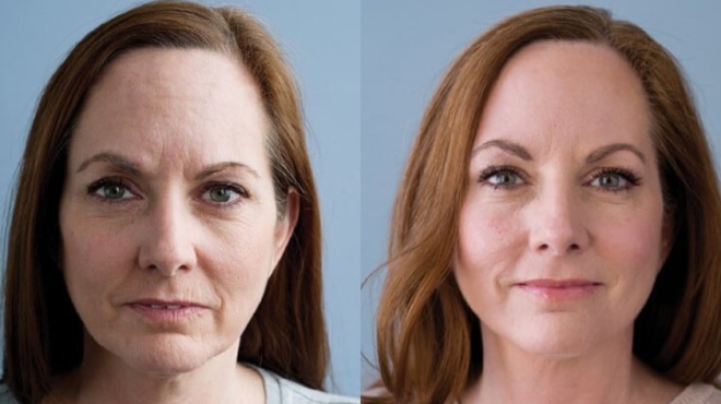 10-kathimerina-lathi-poy-se-kanoyn-na-deichneis-poly-megalyteri-apo-tin-pragmatiki-ilikia-soy-453032