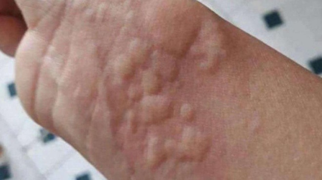 ti-simainoyn-ta-simadia-sto-derma-464957