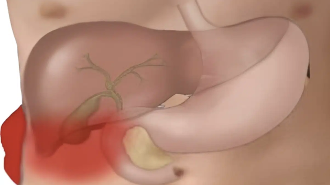 to-fapmako-toy-ftochoy-i-pamfthini-trofi-gia-ena-ygies-entero-462999