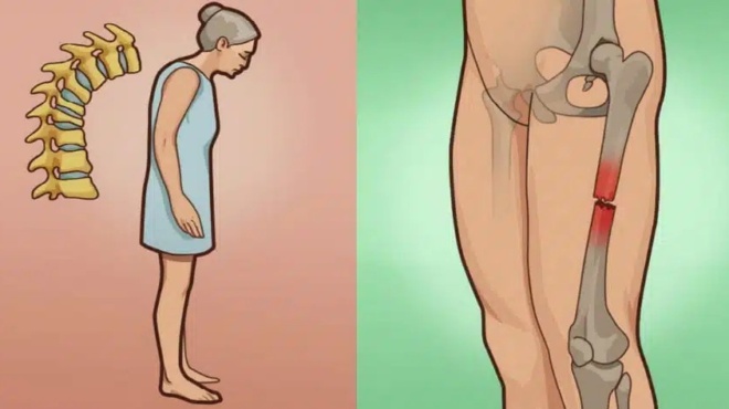 osteoporosi-to-elliniko-votano-poy-dynamonei-kai-prostateyei-ta-kokkala-489773