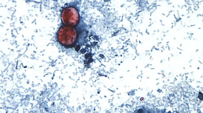 synagermos-gia-parasito-poy-se-stelnei-kateytheian-amp-8230-toyaleta-prokalei-ateleioti-diarroia-amp-8211-se-poia-fagita-kryvetai-amp-8211-145-kroysmata-489929
