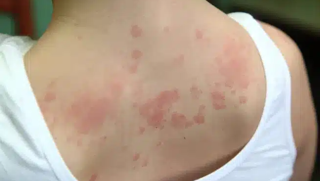 an-deite-ayta-ta-simadia-sto-derma-sas-min-ta-agnoisete-oi-aprosmenoi-logoi-poy-emfanizontai-kai-ligoi-gnorizoyn-513065